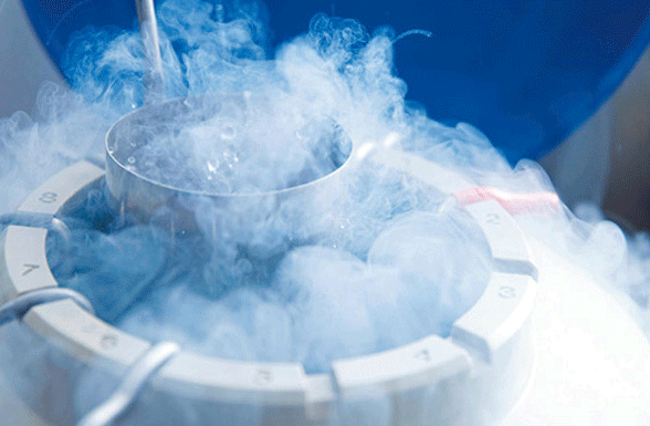 Congelation des embryons